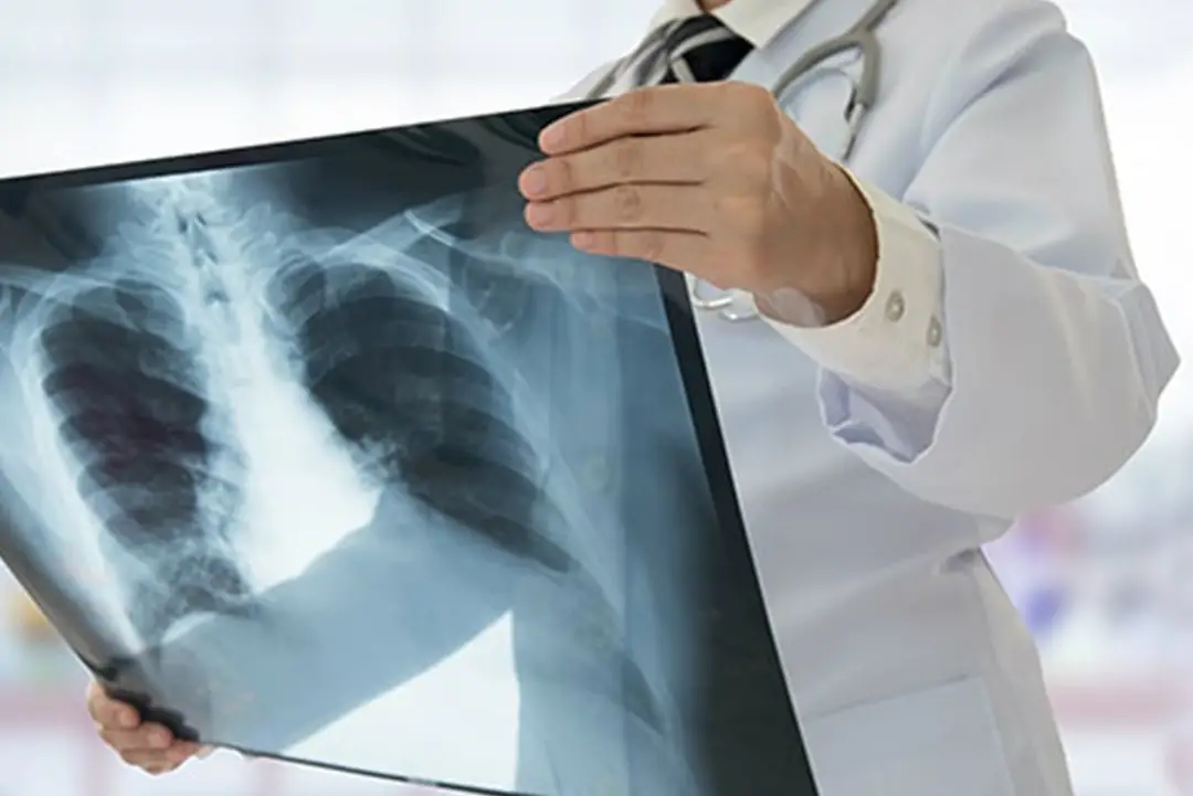 İŞE GİRİŞ SAĞLIK RAPORUNDA İSTENECEK TETKİKLER NELERDİR ?